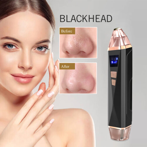 Pimple Blackhead Remover (2)